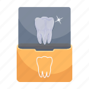 dental xray, tooth xray, dental report, xray, dentistry