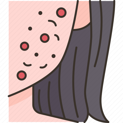 Pimple, skin, acne, blemish, treatment icon - Download on Iconfinder