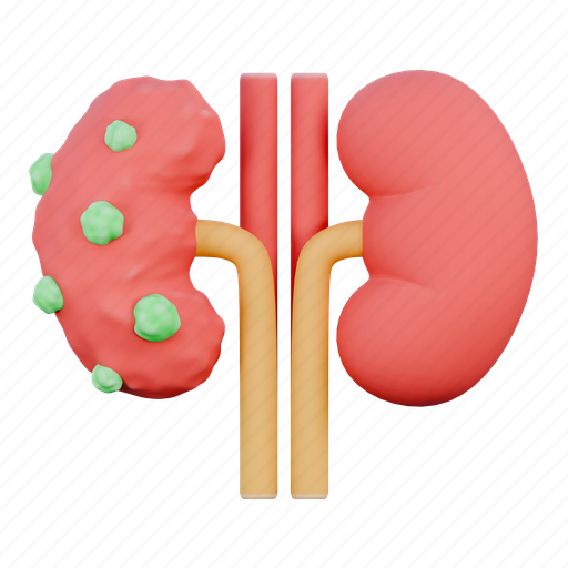 Kidneys, tumor, illness, anatomy, nefrolitiasis, body, organ icon - Download on Iconfinder