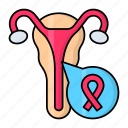 vaginal, contraception, cancer, tumor, birth canal, vagina, ribbon sign