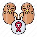 kidneys, cancer, renal cancer, damaged, kidney, ribbon, tumor