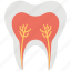 dental, dental pulp, roots, tooth, tooth roots 