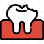 decayed, dental, dentist, healthcare, medical, tooth 