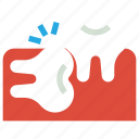 dental, dentist, healthcare, impacted, medical, tooth
