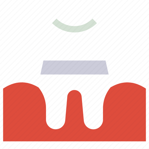 Crown, dental, dentist, healthcare, implant, medical, tooth icon - Download on Iconfinder