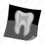 dentistry, tooth, x-ray 