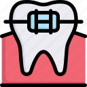 brace, bracket, dental care, dentist, health, orthodontic, tooth