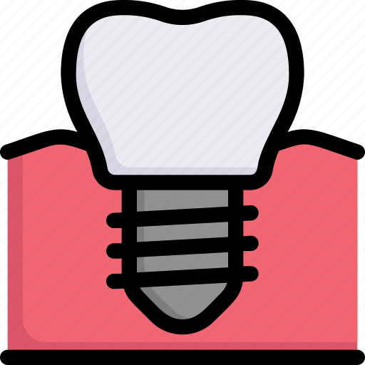 Dental care, dentist, denture, health, implantation, implanted in gum, tooth icon - Download on Iconfinder