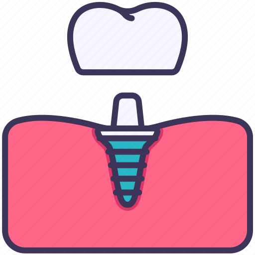 Dental, gum, implant, medical, screw, teeth icon - Download on Iconfinder