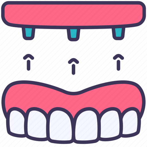 Dental, dentures, full, implant, screw, tooth icon - Download on Iconfinder