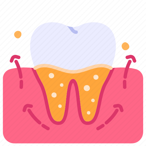 Clean, dental, tooth, treatment, scaling icon - Download on Iconfinder