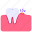 dental, gingivitis, gum, inflammation, pain, swollen, tooth 