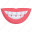 dental care, dentist, health, mouth, oral, smile with teeth, tooth 