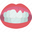 dental, gum, problem, inflammation, oral
