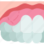 gum, swollen, inflammation, periodontitis, dentistry 