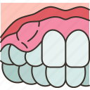 gum, swollen, inflammation, periodontitis, dentistry