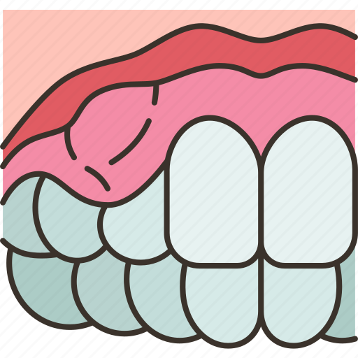 Gum, swollen, inflammation, periodontitis, dentistry icon - Download on Iconfinder