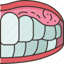 mouth, cancer, oral, carcinoma, disease