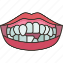 teeth, impacted, deformity, orthodontic, problem