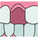 teeth, loose, toothless, dental, oral