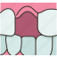 teeth, loose, toothless, dental, oral 
