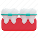 orthodontics, beauty, braces, dental, dentistry, teeth, 3d 