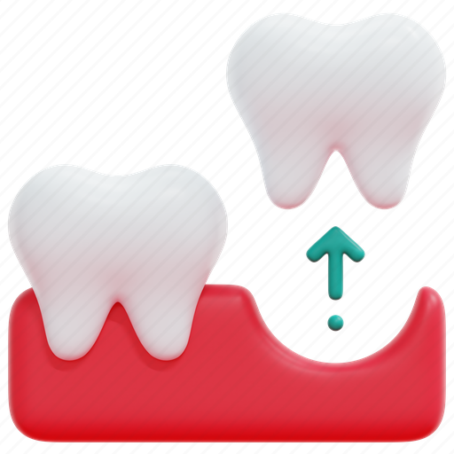 Tooth, extraction, remove, dental, loss, care, 3d 3D illustration - Download on Iconfinder