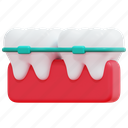 orthodontics, beauty, braces, dental, teeth, dentistry, 3d 