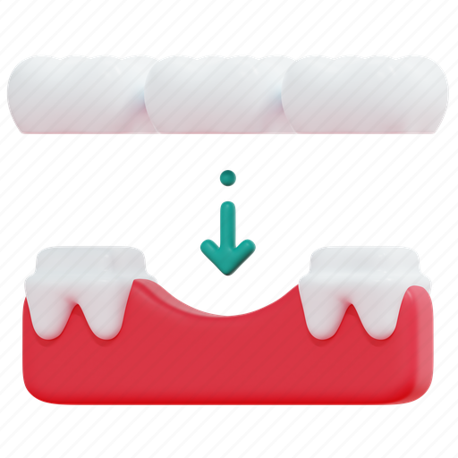 Bridge, dental, tooth, implant, care, dentist, healthcare 3D illustration - Download on Iconfinder