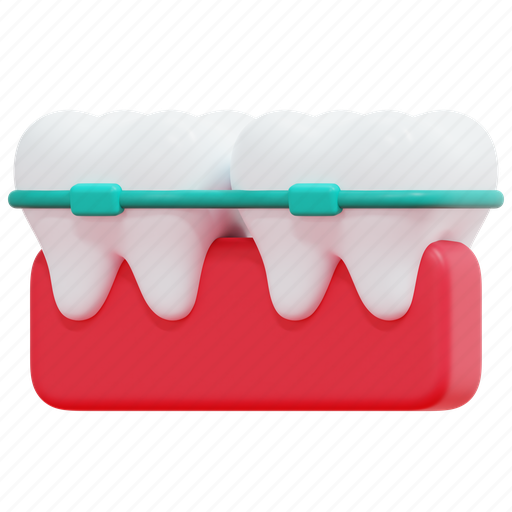 Orthodontics, beauty, braces, dental, teeth, dentistry, 3d 3D illustration - Download on Iconfinder