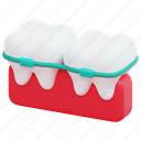 orthodontics, beauty, braces, dentistry, dental, teeth, 3d 