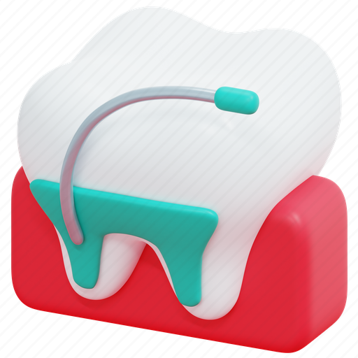 Root, canal, dental, endodontics, tooth, medical, treatment 3D illustration - Download on Iconfinder