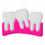 clinic, dentist, molars, tooth 