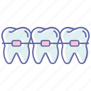 braces, dental braces, dental bracket, dental parentheses, dentist, orthodontic case, teeth straighten