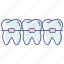braces, dental braces, dental bracket, dental parentheses, dentist, orthodontic case, teeth straighten 