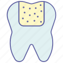 dental care, dental composites, dentist, dentistry, tooth filling, white fillings