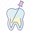 dental aid, dental procedure, dentist, endodontic therapy, root canal, tooth therapy