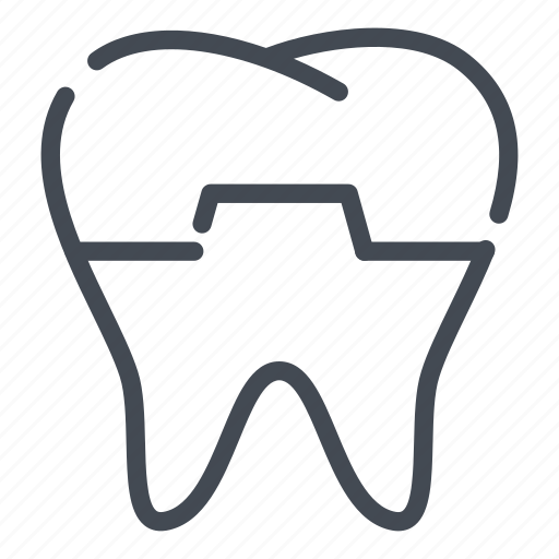 Crown, dental, dentist, dentistry, stomatology, teeth, tooth icon - Download on Iconfinder