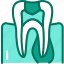 periodontitis, inflammation, periodontal, disorder 