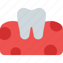 tooth, gum, medical, dentistry