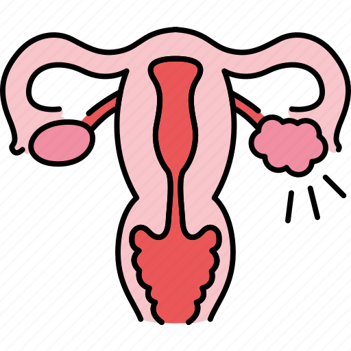 Uterus, disease, woman, pcos, female icon - Download on Iconfinder