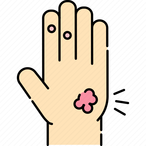 Warts, hand, palm, dermatology icon - Download on Iconfinder