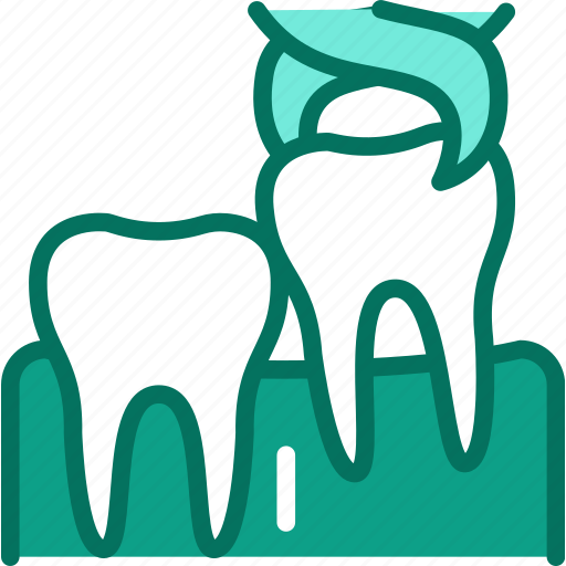 Wisdom, tooth, extraction icon - Download on Iconfinder