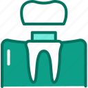 dentistry, crowned, teeth