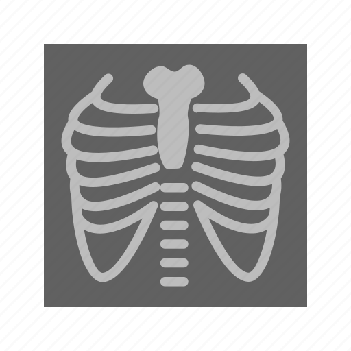 Bones, chest, image, lungs, medical examination, ribs, x ray icon - Download on Iconfinder