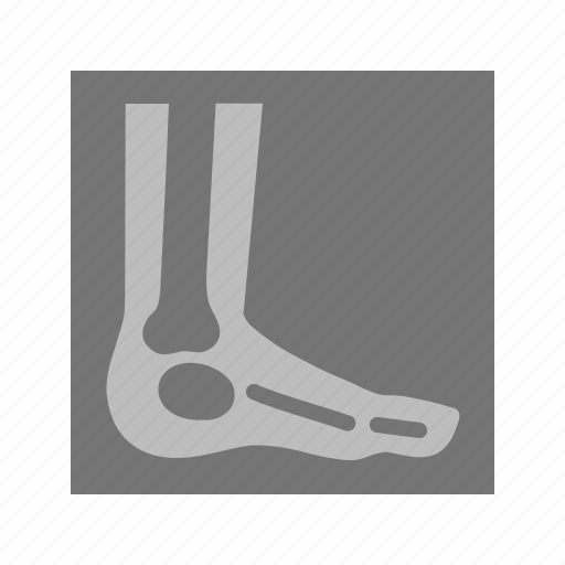 Ankle, bones, examination, foot, image, leg, x ray icon - Download on Iconfinder