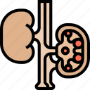 kidneys, renal, urinary, transplant, surgery
