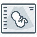 embryo, medical, equipment, ultrasound, medical equipment