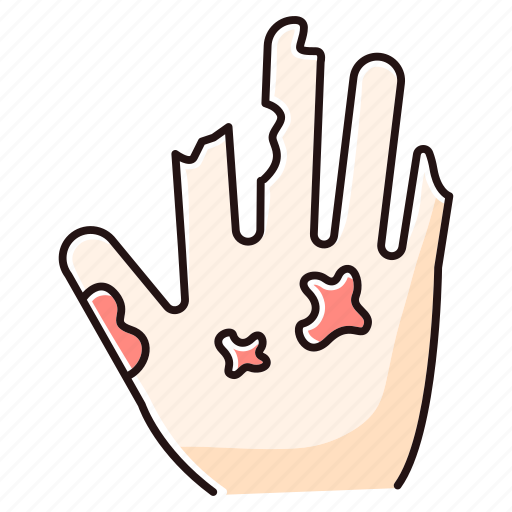 Bacterial, color, disease, hand, illness, infection, leprosy icon - Download on Iconfinder