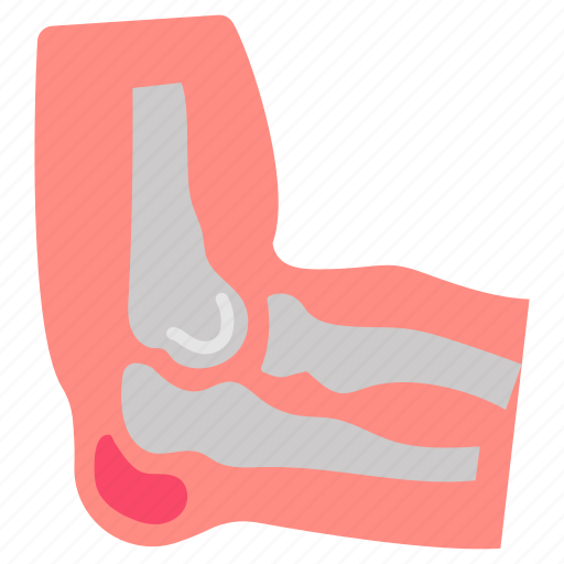 Elbow, joints, bones, joint, pain, medical, examination icon - Download on Iconfinder